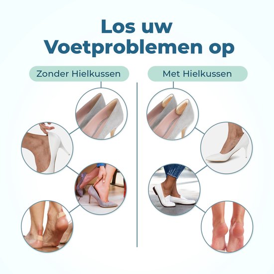 Shoeple Heelpad One (4 stuks) - Hielkussentjes voor Schoenen - Schoenverkleiner - Antislip Hielzool - Hielbeschermer - Beige